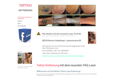 tattoo-laser-entfernung.eu - Tätowierer Delmenhorst